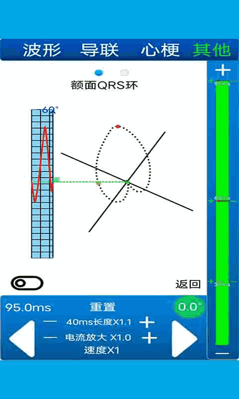心电图计算器截图1