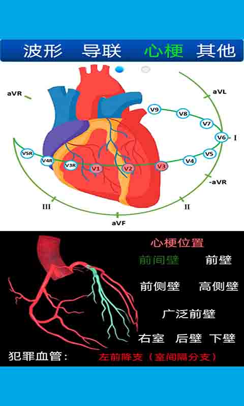 心电图计算器截图2