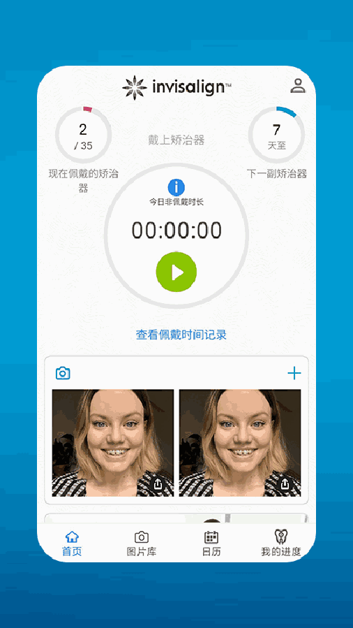 My Invisalign截图1